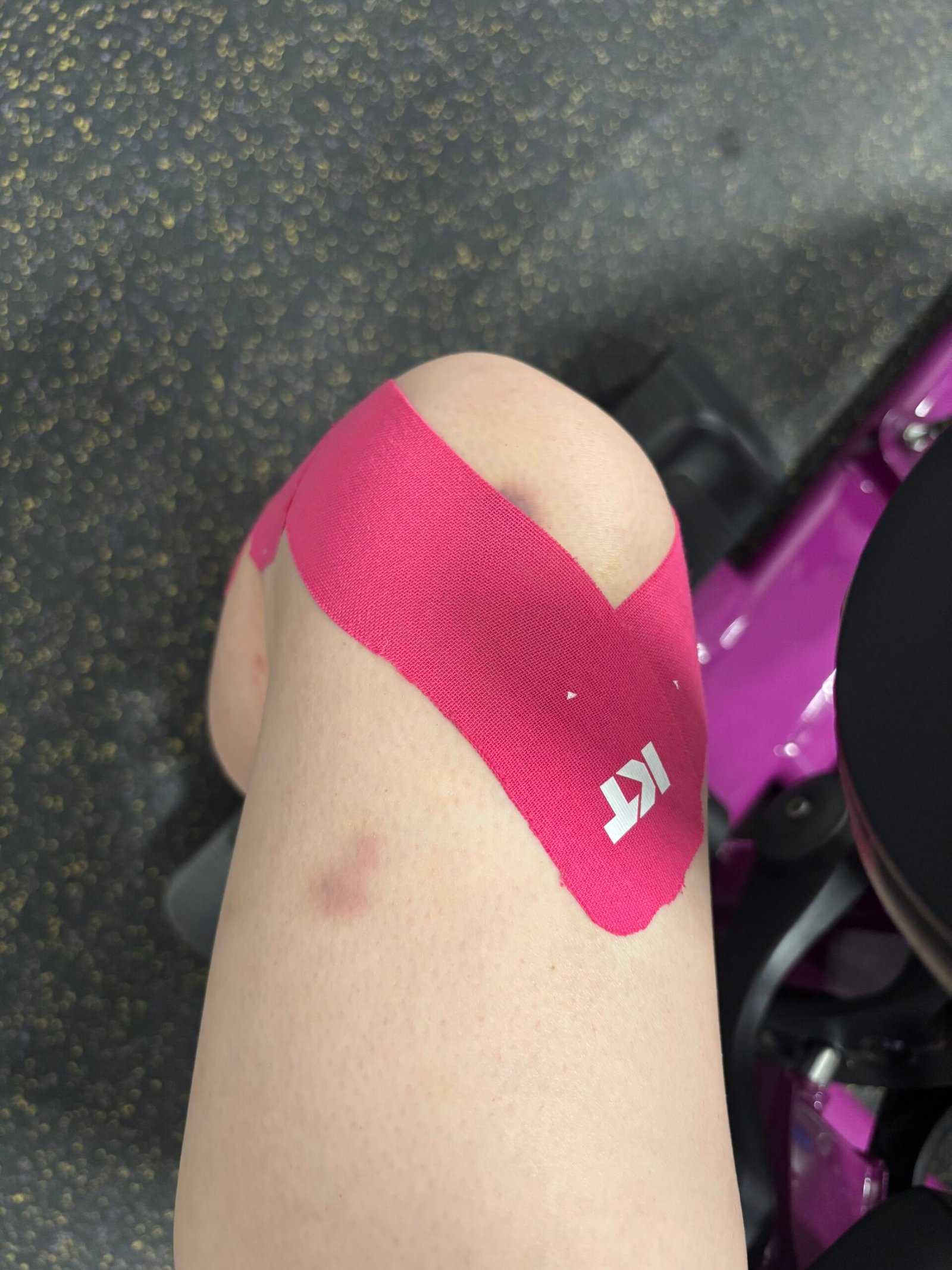KT tape applied to knee for runner's knee support